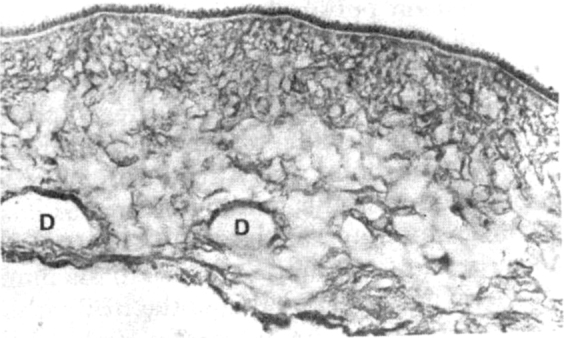 Fig. 1B