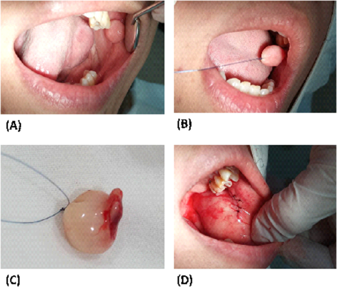 Fig. 4