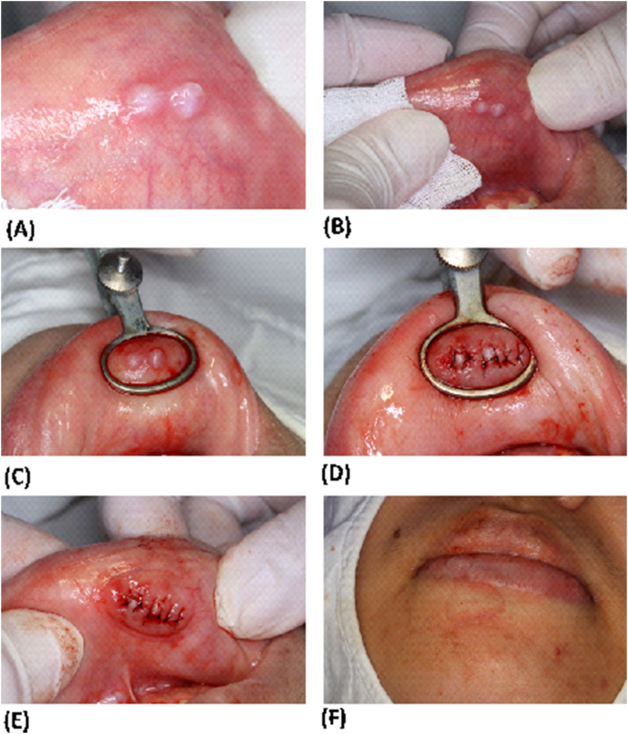 Fig. 3