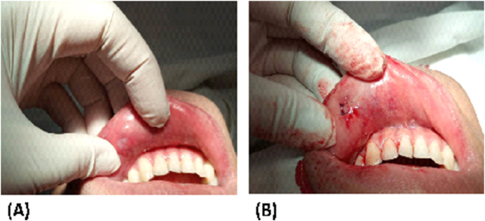 Fig. 1