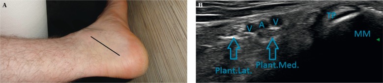 Fig. 11