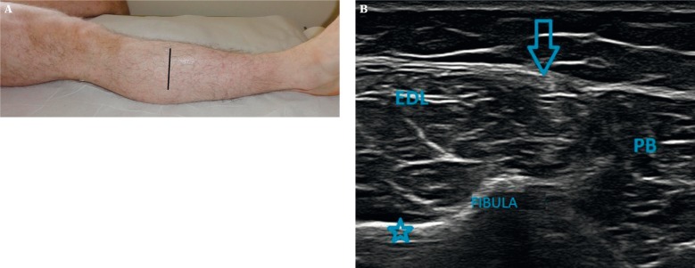 Fig. 13