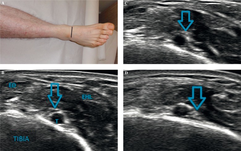 Fig. 15