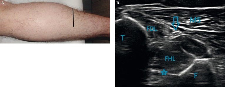 Fig. 9