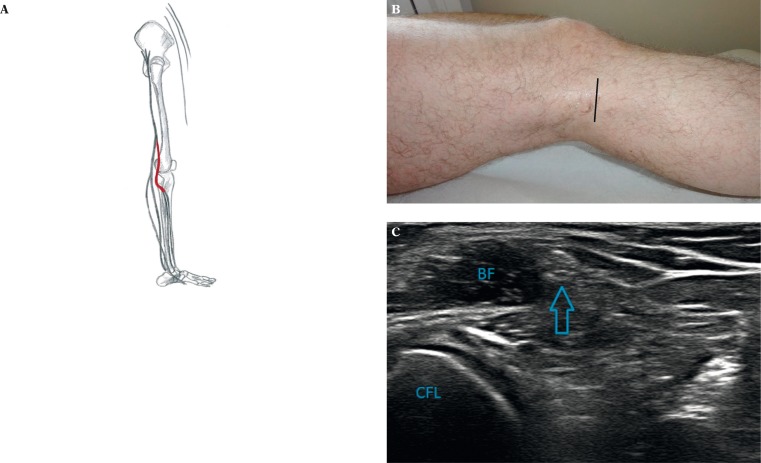 Fig. 12