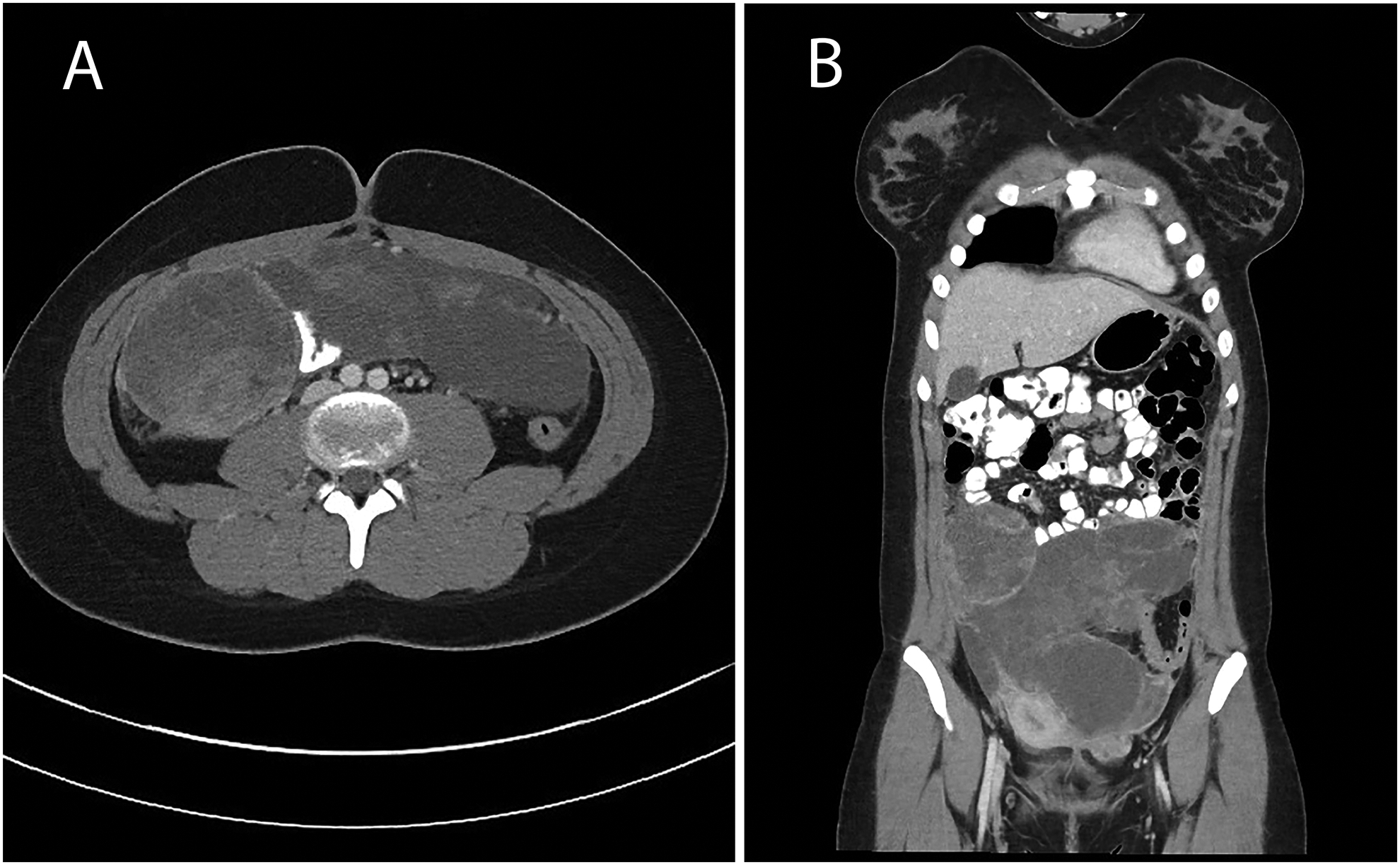 Fig. 3: