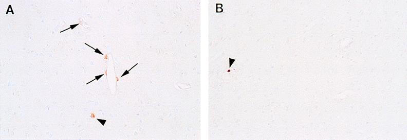 FIG. 9