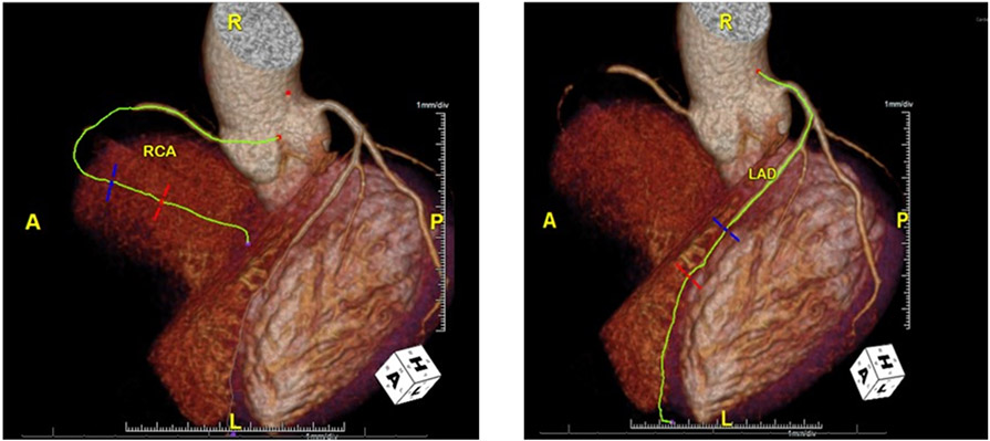 Fig. (1).