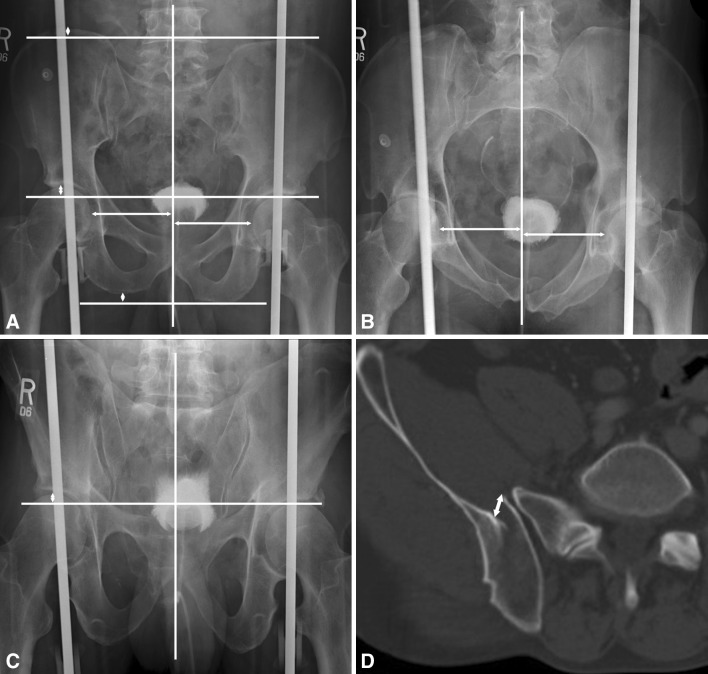 Fig. 2A–D