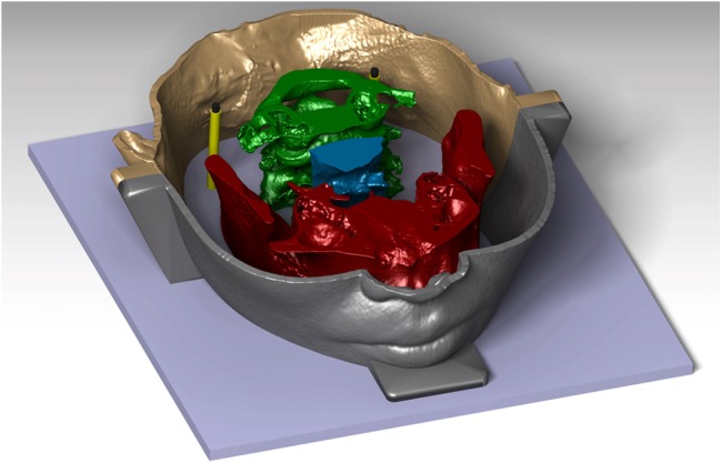 Figure 2