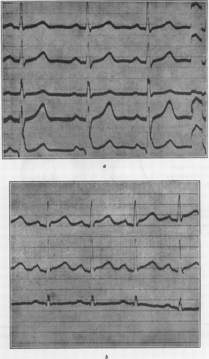 graphic file with name thorax00006-0010-a.jpg