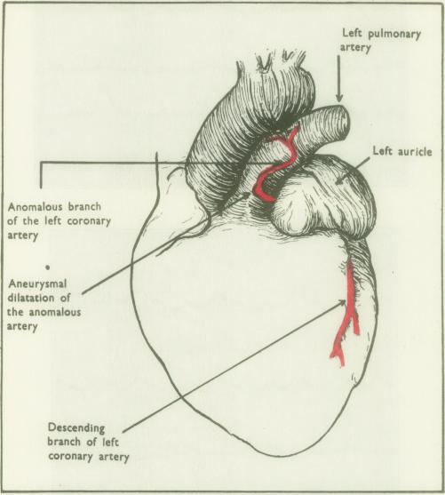 graphic file with name thorax00006-0011-a.jpg