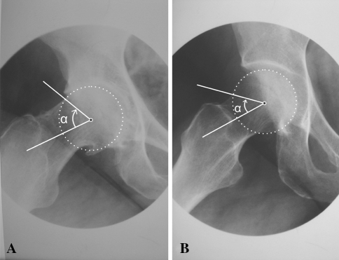 Fig. 2A–B