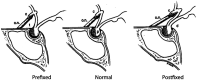 Figure 6-1.