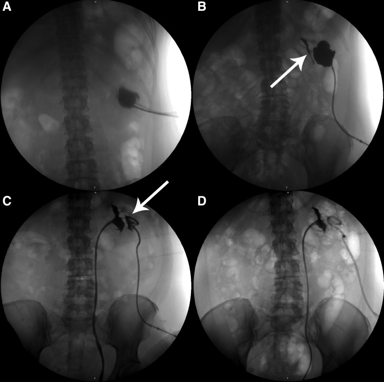 FIG. 4.