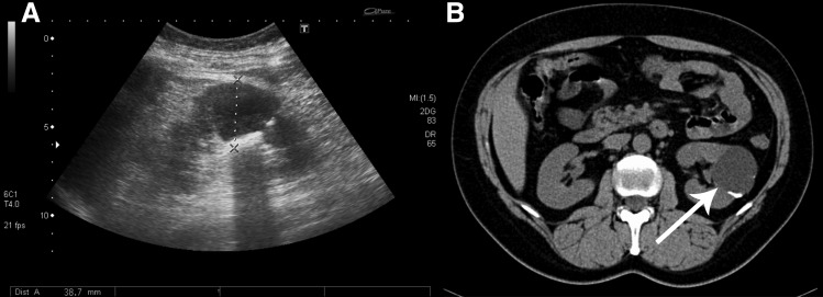 FIG. 1.