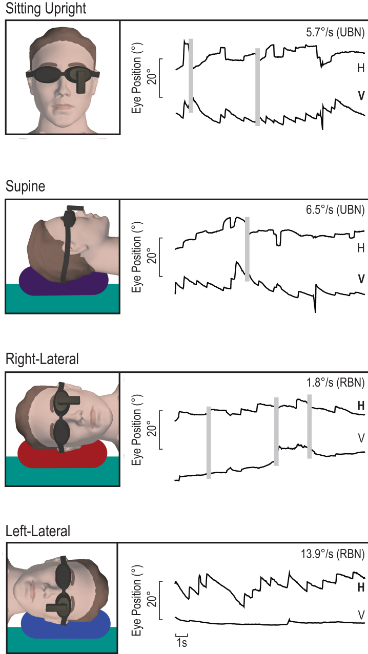 Fig.2