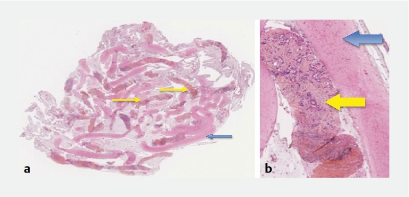 Fig. 3 a