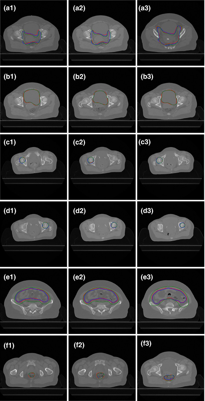 Fig 5