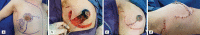 Figure 12a-d