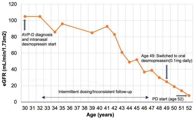 This graph shows a patient’s eGFR decline over time using the CKD-EPI 2009 calculation with no race adjustment, from a younger age to the age of 52, including points of treatment changes.