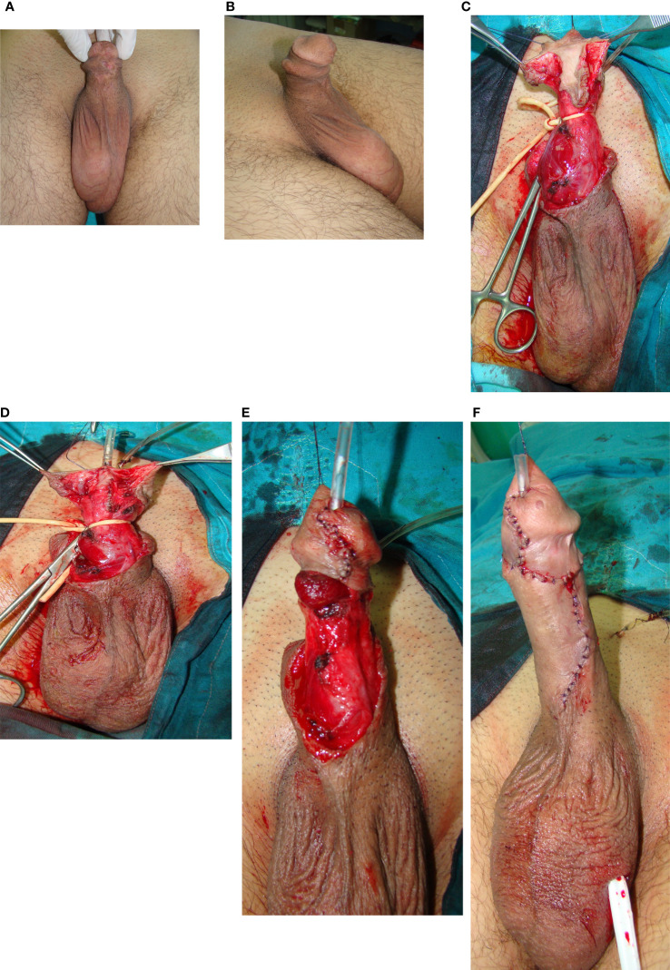 Figure 1