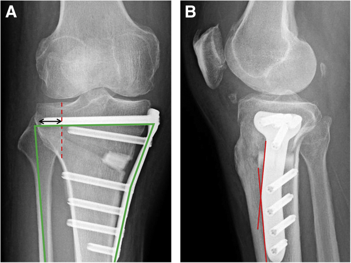 Fig 4