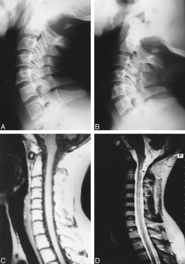 fig 2.