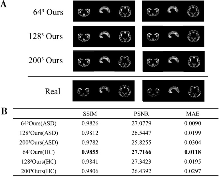 Generation and discrimination of autism MRI images based on autoencoder ...