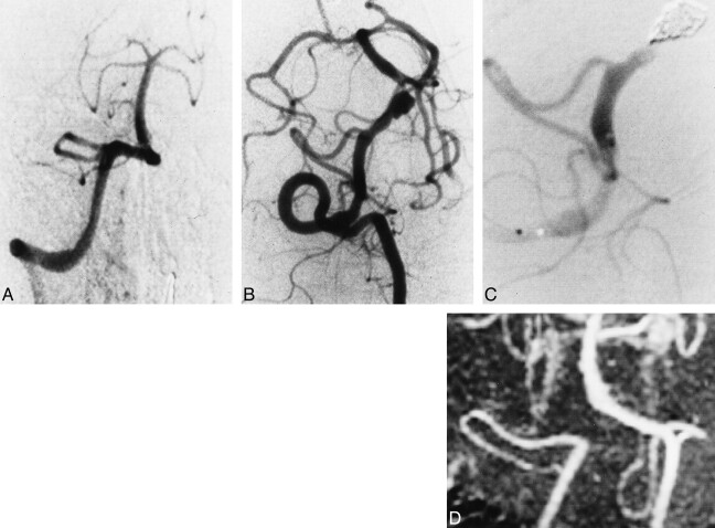 fig 1.