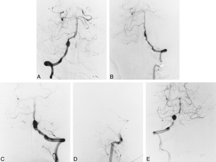 fig 3.