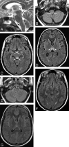Fig 3.