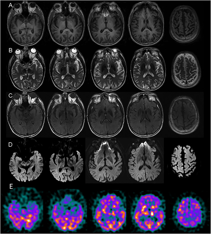 FIG. 1