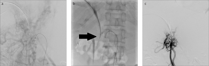 Figure 2. a–c