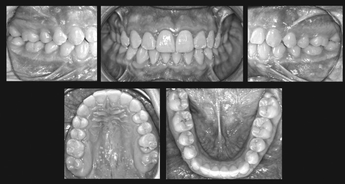 Figure 8. Posttreatment intraoral photographs.