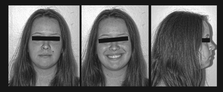 Figure 9. Posttreatment extraoral photographs.