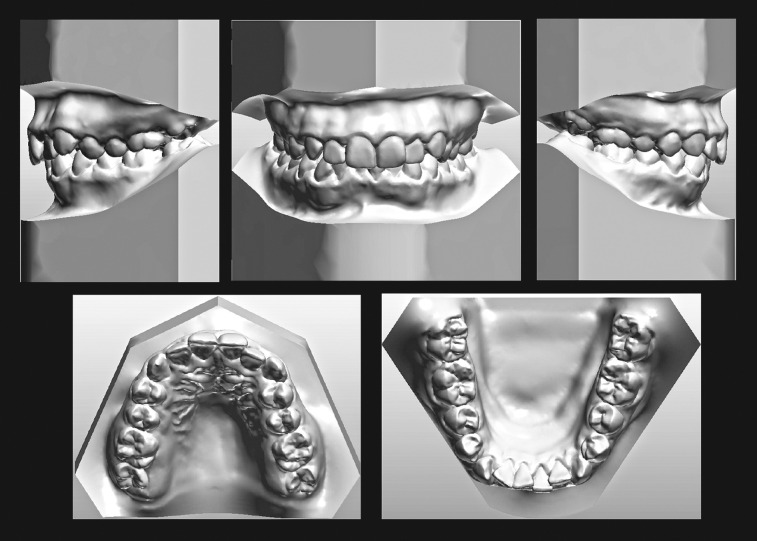 Figure 3. Pretreatment virtual 3-D models.