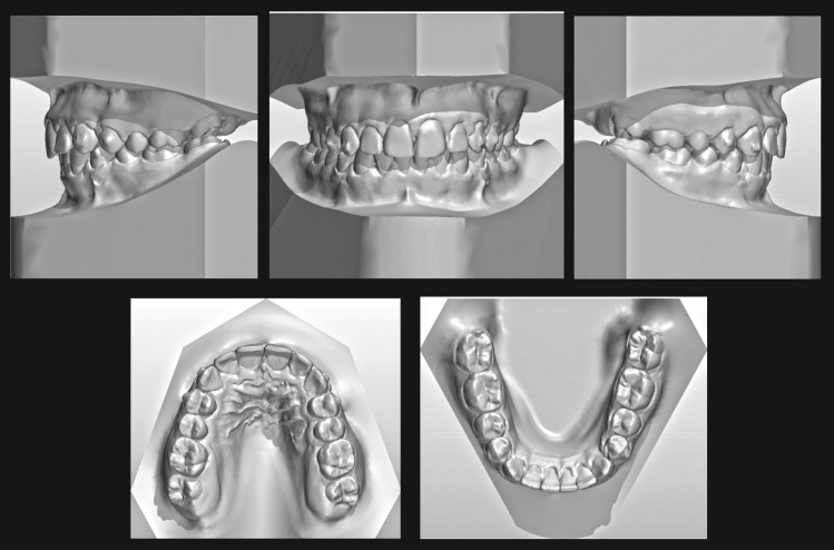 Figure 7. Posttreatment virtual 3-D models.