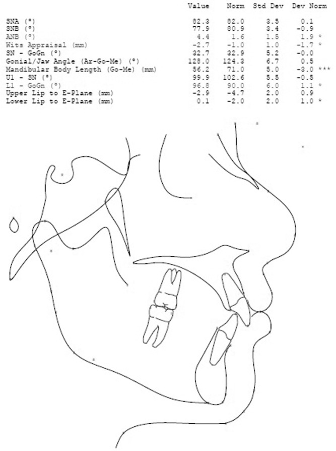 Figure 4. Lateral cephalometric analysis.