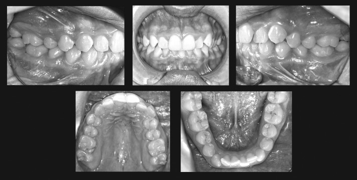 Figure 2. Pretreatment intraoral photographs.