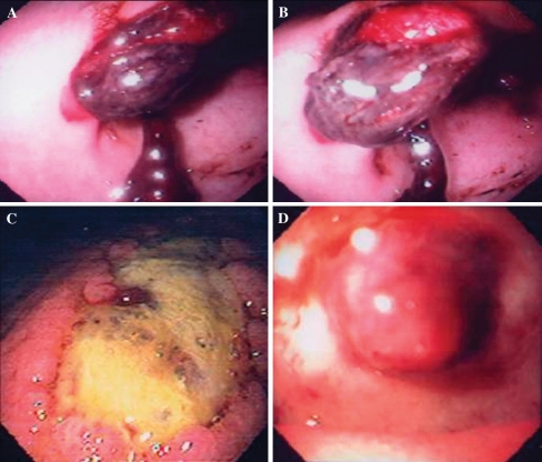 Fig. 1