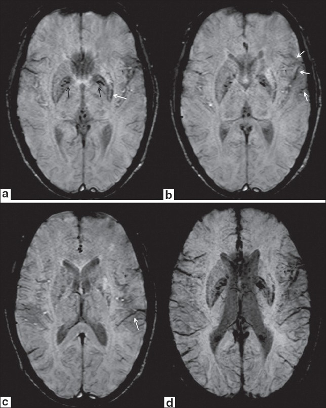 Figure 2 (a-d)