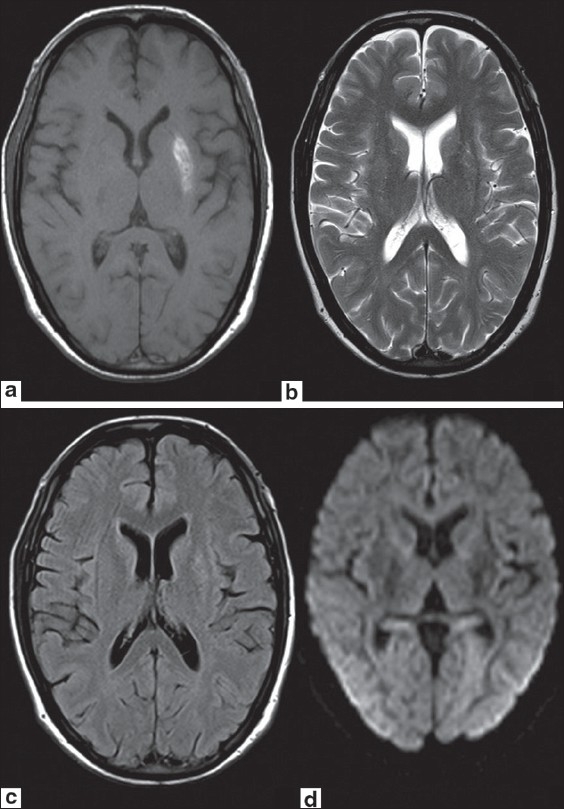 Figure 1 (a-d)