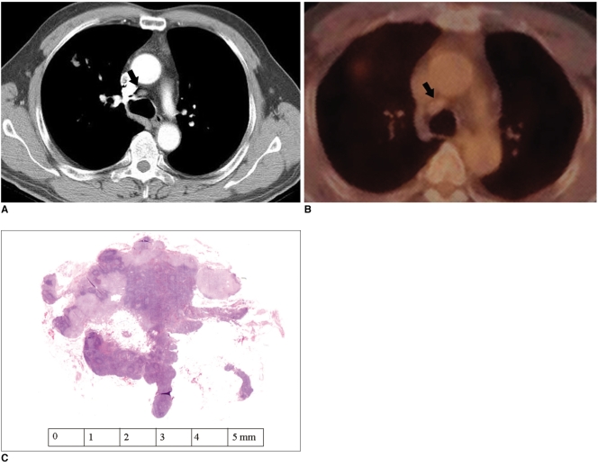 Fig. 15