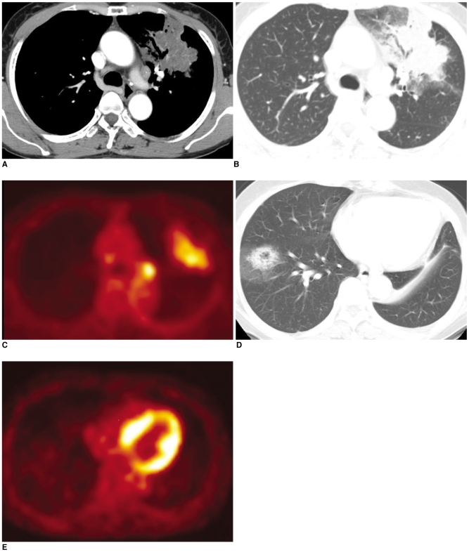 Fig. 14