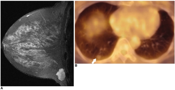 Fig. 16