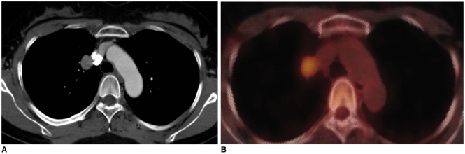 Fig. 12