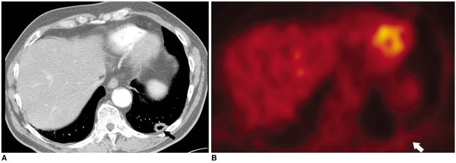 Fig. 13