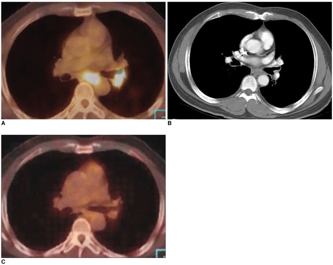 Fig. 18