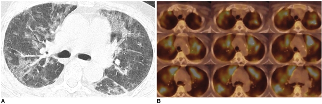 Fig. 9